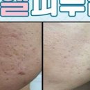탱탱피부관리샵 이미지