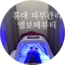 엘보떼 네이버블로그