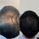 채오름SMP 이미지