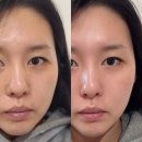 당수초등학교 | 당수동피부샵 에스떼솔 피부관리 찐맛집 내돈내산 후기!