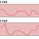 조증과 우울증의 교차 - 양극성 장애 이미지