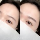 아인뷰티의원 이미지