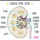 신부전증과자연치유 이미지