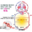 자연정혈요법 이미지