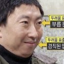 최안과의원 네이버블로그