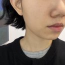 리투필라테스 | [신논현 성형외과] 엘라비에 리투오 스킨부스터 가격 및 후기, 다운타임, 비포/애프터
