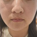 충무공동27 | [진주 충무공동 피부관리] 여드름 진정부터 깐달걀 피부까지! 영화로운 에스테틱&amp;헤드스파 후기 💆‍♀️