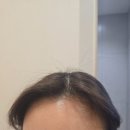 진심 하나도 안아픈 무통왁싱 후기, 왁싱삼공 논현점, 당일예약, 헤어라인 왁싱