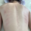 유림에스테틱 - 익산시 하나로10길 3 | 광안리 약손관리 잘하는 약손유림에스테틱 등관리 후기