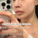 삼성동-7 | 삼성동 온다리프팅 대만족한 후기