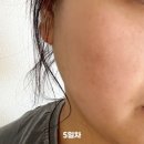 효자의원 | 송도 밴스의원 인모드 n차 인생… 이젠 안 하면 이상한 내돈내산