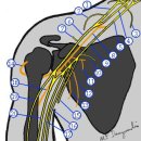 Brachial Plexus 이미지