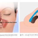 뉴원성형외과의원 | 부산 코수술 성형외과 손품·발품 실제 후기
