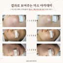 성민아카데미 | 실제 고객 피부 변화 사례로 배우는 문제성 피부 수강- 대구 미소아카데미 에스테틱 실무중심반