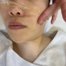 서산피부관리 제이스킨앤바디 아르케스킨메이트 관리 후기