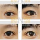 에스라인 이미지