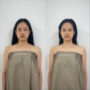 신동-16 | [익산] 신동 피부관리 정든에스테틱 땅콩형얼굴 윤곽관리 솔직후기(비포&amp;에프터有)
