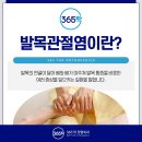 365탁정형외과의원 | 배곧정형외과의원 발목관절염 치료는?