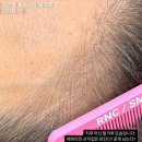 장선헤어 | 서현 헤어라인문신 자연스러운 커버를 원한다면
