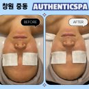 소답동240 | 창원 중동 피부관리 어센틱에스테틱 1:1 맞춤 수분물광&amp;플라즈마관리 후기