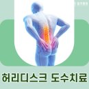 잠실역 정형외과 초기 허리디스크에 효과적인 치료법은 이미지