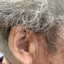 일산 보청기 이미지