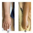 대진카센터 | [경기 광주] 프라이빗한 경기광주왁싱샵에서 팔 왁싱하고 온 후기! : 뽐왁싱 앤 뷰티