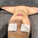 B 테크니션 | 부천피부관리 가인미가에서 브이라인 얼굴 윤곽 마사지 턱선리프팅 후기