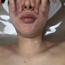 3404 | 대전 피부관리 잘하는 곳 도안동 혜리쌀롱에서 윤곽관리 받은 후기