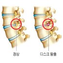 애룰바디 이미지