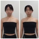 [목동 피부관리] 쏘영피부연구소에서 두골비관리로 비대칭 개선 후기