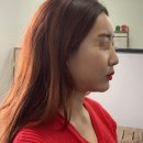 제이와이성형외과의원 네이버블로그