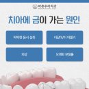 구암동295 | 대구구암동치과 치아 실금이라도 무시하면 안 되는 이유