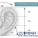소이메디칼 네이버블로그