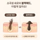 한코교역(주) | 코 검은점 정체는 소극성 속모증! 블랙헤드와 차이점 + 쏙모팩 사용 후기