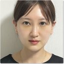 배치 | 눈밑지방재배치후기 (잘하는병원부터 수술후 변화 추이 기록까지)