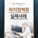 고운하지흉부외과의원 | [사례] 하지정맥류 레이저 시술 후기