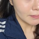 루디아유통 | 루디아 모공세럼으로 블랙헤드 케어 시작! 루디아 포어 케어 퓨리파잉 세럼 사용 후기