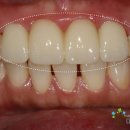 청담치과기공소 이미지