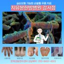 여의도정성한의원 | “연예인 매니저도 무좀? 강서 마곡 여의도 목동 발톱무좀 겉으론 화려해도 속은 곪는다 치유본한방병원...