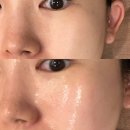 마산회원구 ⓕ-13 | 마산피부관리 에르모소 손길이 다른 마산에스테틱 후기 좋은 이유가 있는 마산피부샵
