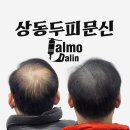 상동스카이뷰자이 | 부천 상동두피문신 잘하는곳 탈모달인의 자연스러운 밀도보강