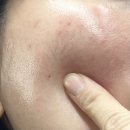 참바른약국 | 피부가려움증 완화와 피부장벽 케어, EGF 재생크림 후기 – 약국화장품 지피덤 이지에프