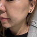 기업도시로2 | 타토아비욘드 기업도시점 – 라라필, PDRN 관리 후기