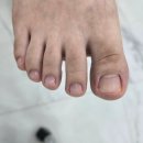 세웅 약국 | 부산내성발톱 레푸스 만족스러운 정성관리