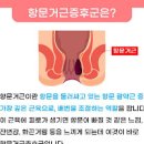 항문거근증후군 증상 및 치료 (엉덩이 항문 통증, 잔변감) 이미지