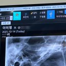 서울수려한치과병원 네이버블로그
