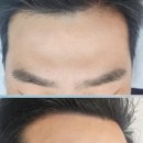 미가헤어라인 이미지