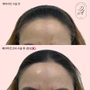 디어니즈 이미지