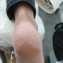 [춘천 하이푸스 후기] 그루트 같은 남편 발 (하;;) 애기발 만들기👼👣